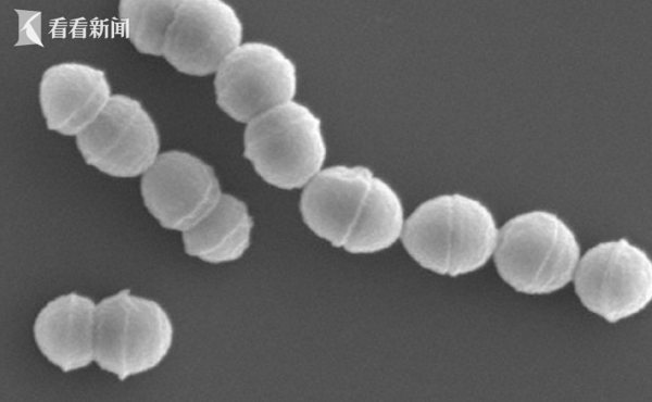 炒股配资时间 日本爆发“食人菌”感染！死亡率高达30%_大皖新闻 | 安徽网